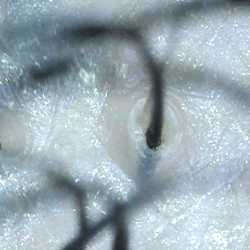 肌の乾燥や毛穴の開きが見られます