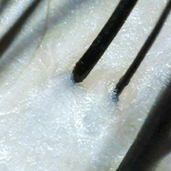 髪の鍼や毛穴の引き締まった様子が確認できます